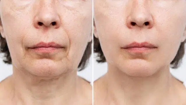 Injectable treatments