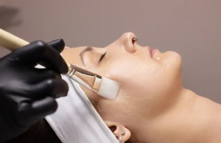 How Do Chemical Peels Work?