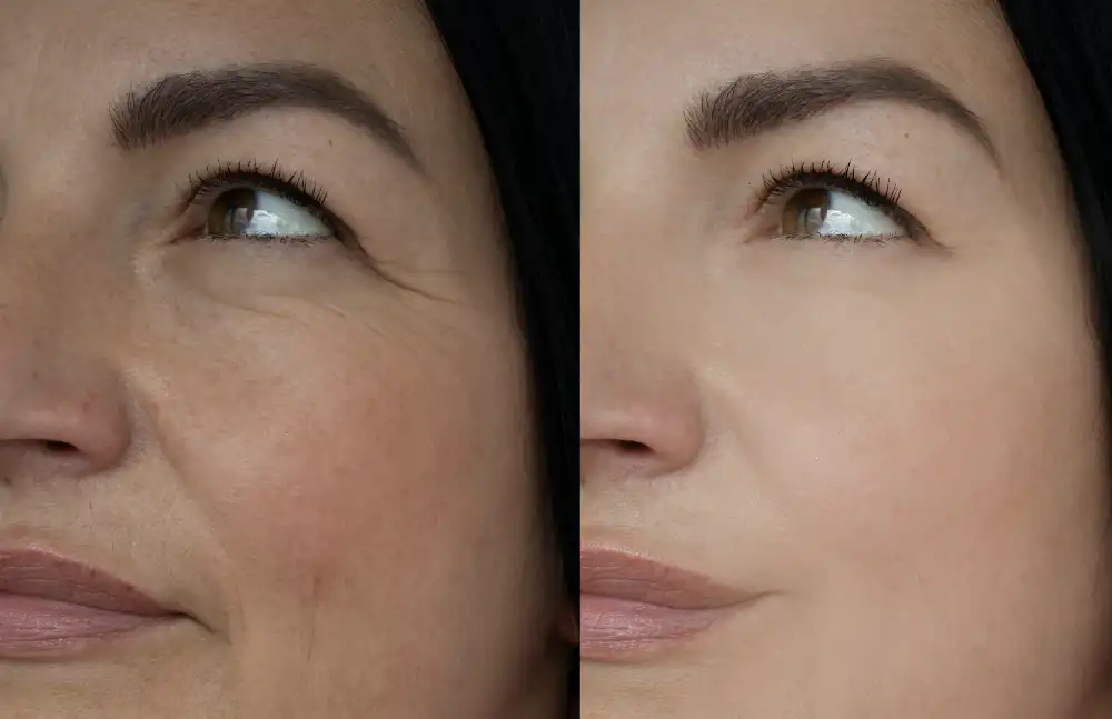 Injectable Treatments near McKinney, TX