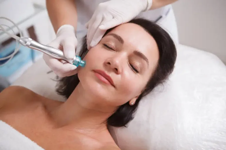 Benefits of PRP-enhanced microneedling: