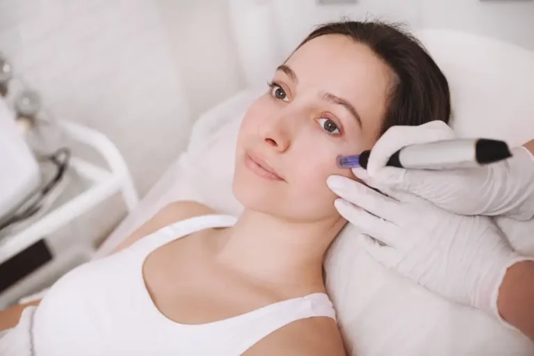 Benefits of Microneedling